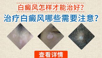 预防护理-白癜风患者的白斑为什么会发红